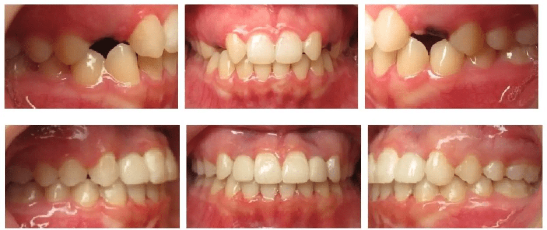 montgomery orthodontics