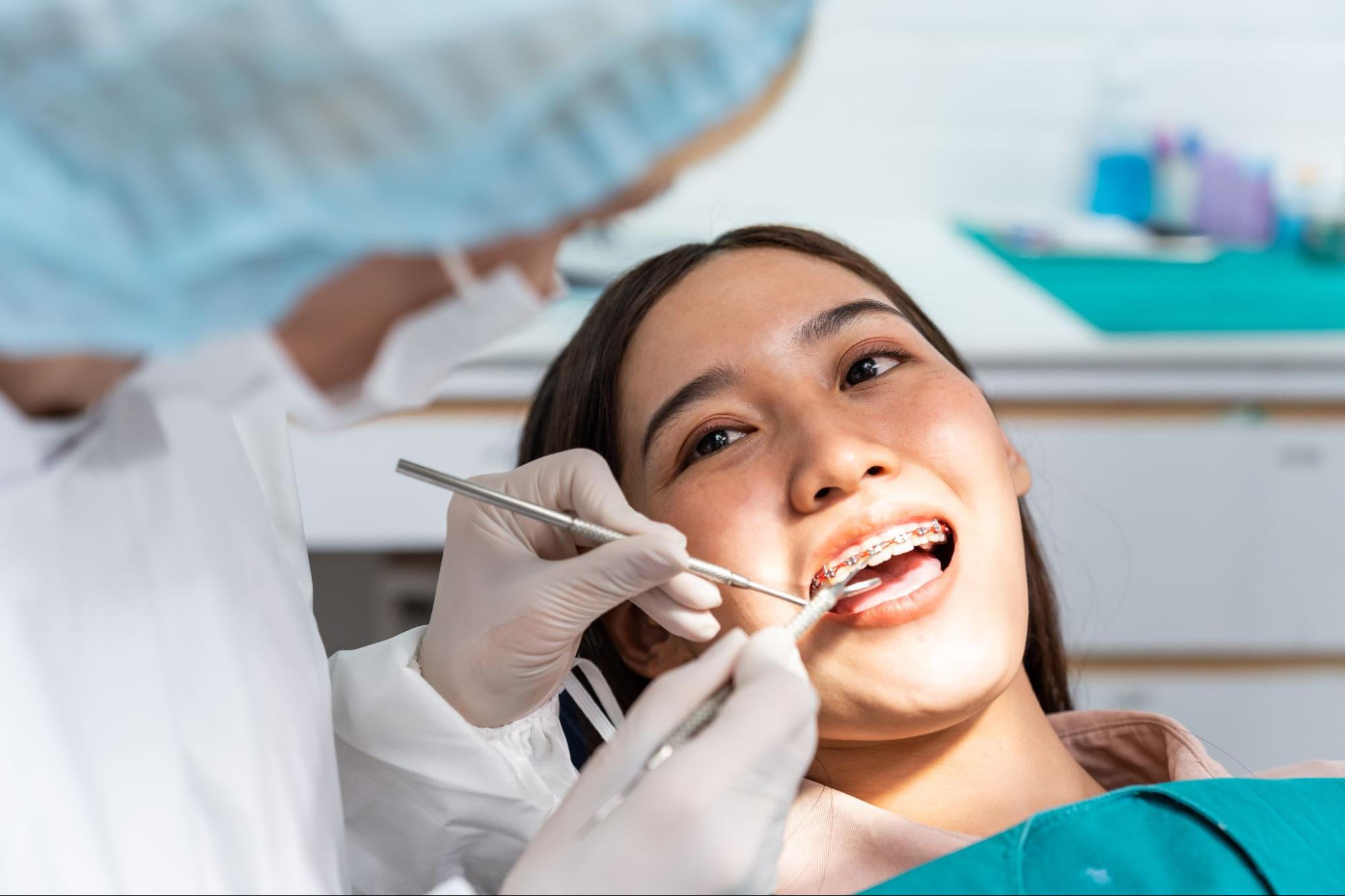 A Guide for Oral Hygiene with Braces